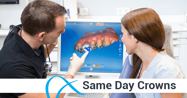 Same Day Crowns – A Modern Approach to an Age-Old Solution